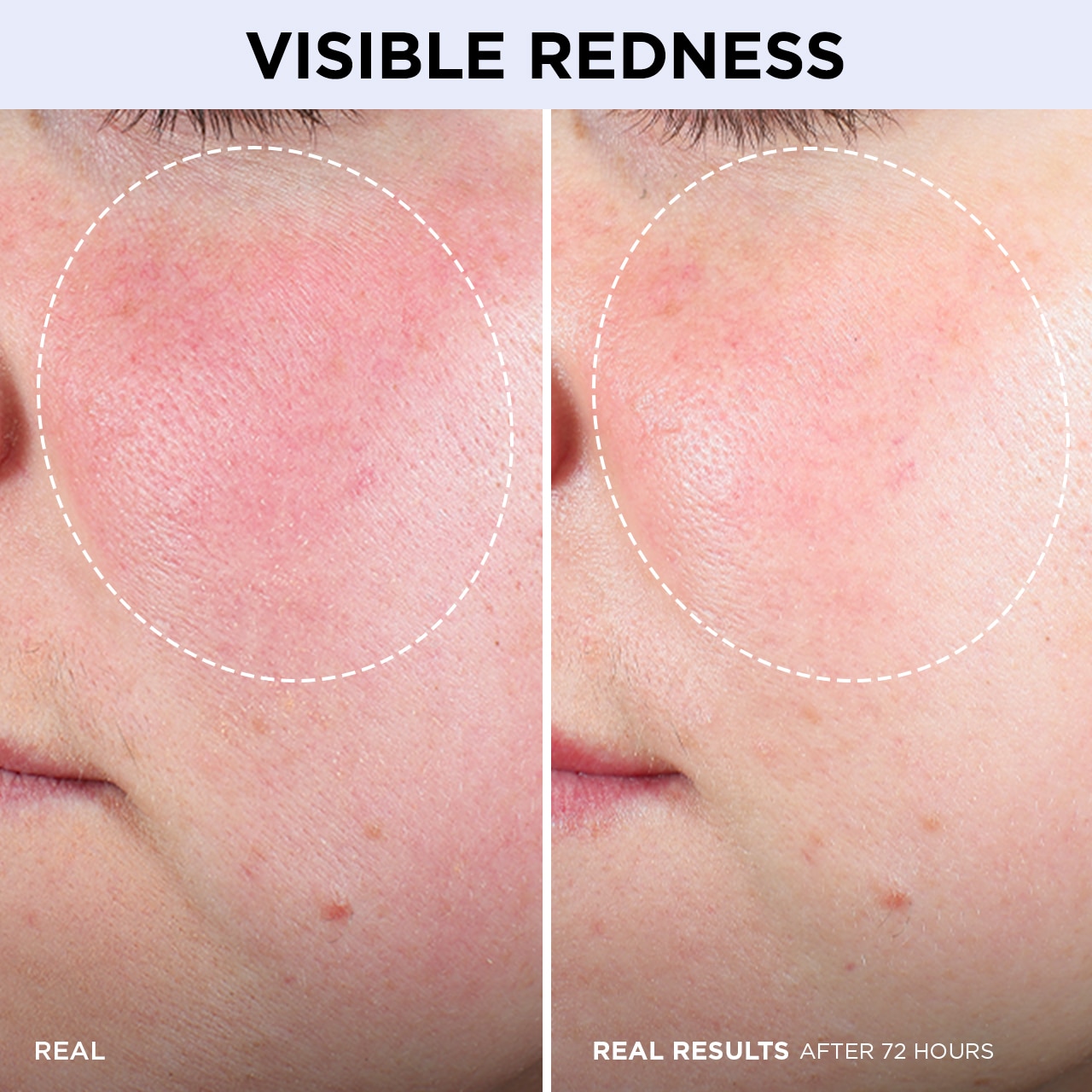 CONFIDENCE IN A CREAM BARRIER BOOST (CREMA HIDRATANTE PARA ROSTRO)